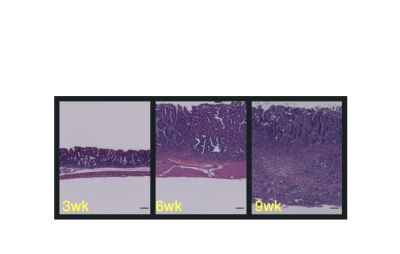 Gastric Cancer progression in mice
